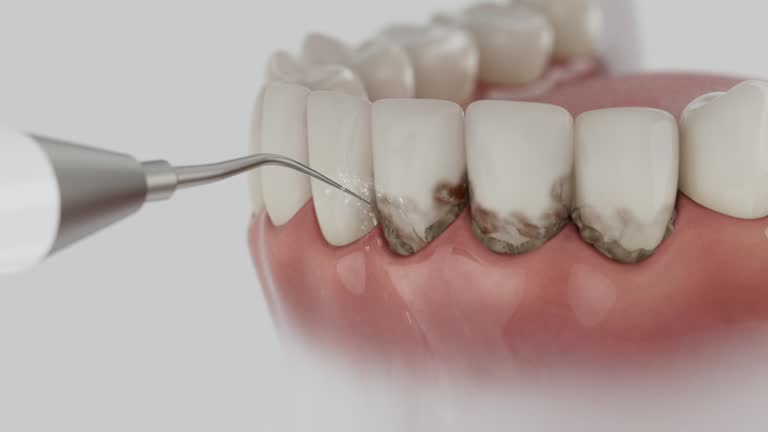Trusted Tooth Extraction service in Goodwater, AL - Dentist Open Now